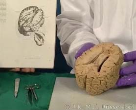 Demo des Sulcus lateralis und der Insel nach Komaromy